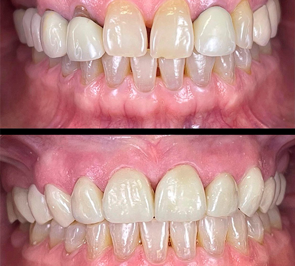 WhatsApp Image 2024-09-07 at 1.27.57 PM (4)